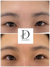 ビューティーベリッシモ(Beauty Bellissimo)/《重い瞼もパッチリ瞳に！》