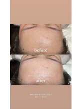 オット(otto)/［オプション］額wax