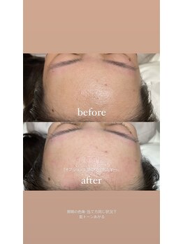 オット(otto)/［オプション］額wax