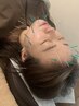 【小顔効果】40本電気美容鍼《小顔鍼灸》マイクロカレント＆カッサマッサージ