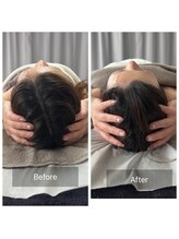 アンド リュクス(& Luxe)/脳洗浄小顔ヘッドマッサージ！