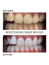 ホワイトニングショップ 新小岩店/ホワイトニング専門店