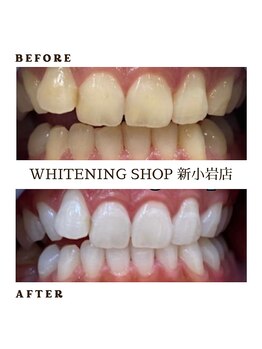 ホワイトニングショップ 新小岩店/ホワイトニング専門店