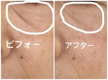 ノーブル シャット Noble Chate/気になる目の下のたるみ＋しわ