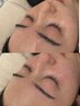 【小顔/美肌/リフトアップ/垢抜け】小顔フルコース＋似合わせ眉毛WAXセット