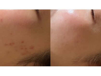 エミルカ 自由が丘店(EMILUCA)の写真