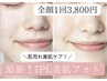 【美肌ケアNo1】IPL美肌フォト全顔3800円！ニキビ、肌荒れケアに◎