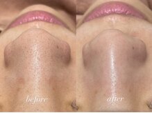 ポアレスラボ ジェンダーレスサロン 横浜/お客様ビフォーアフター