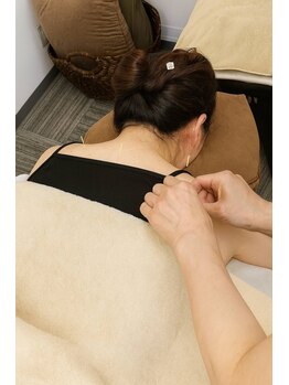 ハリ ヴァカンス(Hari Vacances)/鍼灸施術