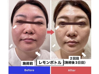 エトワール(etoile)の写真