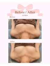 ロココ 安城店(Rococo)/バストアップ症例