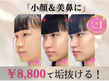 ラプリ 新宿店(Raplit)の写真