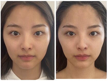 ヘイレン 表参道(Heilen)の写真