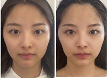 ヘイレン 表参道(Heilen)