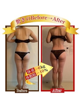 えがお整体院/ビフォーアフター