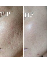 エムエルフ(emuerufu)/