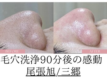 サロン イナンナ(Salon INANNA)/尾張旭エステ/尾張旭脱毛/瀬戸