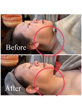 アトリエ ネリネ(Atelier neRine)/フェイスラインをきれいに