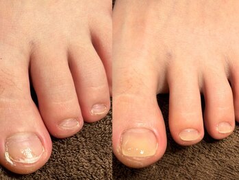 爪切りの正しい使い方知ってる?