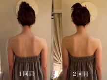 カオン(kaon)/ブライダルエステ2回のお客様