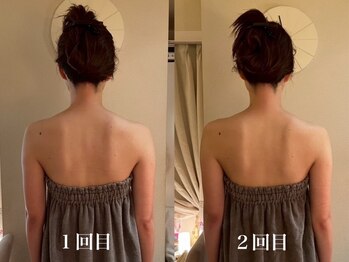 カオン(kaon)/ブライダルエステ2回のお客様