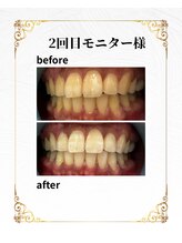 ホワイトニングショップ 葵区静岡駅店/ホワイトニング店ホワイトニング