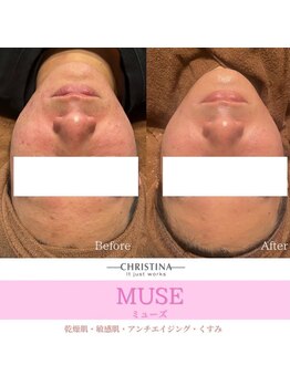 フルアナ(Hu ruana)/フェイシャルエステ