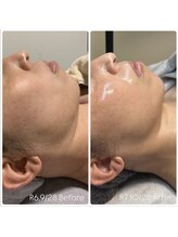 ラグ(LUXU)/水光艶肌ラミピール