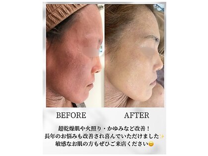 アンベリール(Embellir)の写真
