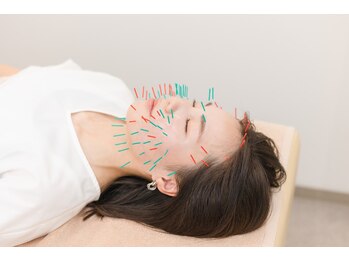 ピアーズ鍼灸整骨院/