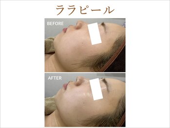 ティアム バイ テトテ 神戸三宮(TIAM by tetote)/ララピール