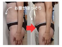 オスマンティエ(Osmantier)/施術ビフォーアフター