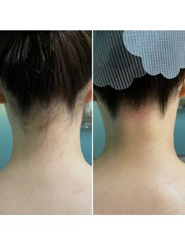 ナチュラヒルズ(Naturahills)/