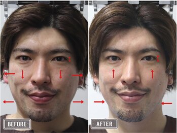 さつま骨格矯正 表参道青山院/歪み小顔矯正＋骨盤矯正