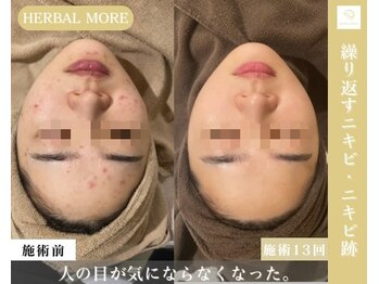 サロン ド レナ(Salon de LENA)