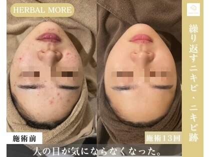 サロン ド レナ(Salon de LENA)の写真