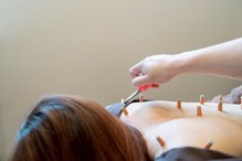 ラックス鍼灸 整体院(Lachs鍼灸 整体院)