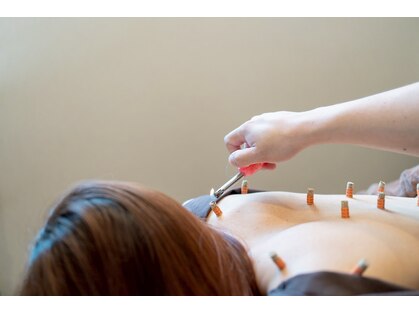 ラックス鍼灸 整体院(Lachs鍼灸 整体院)の写真