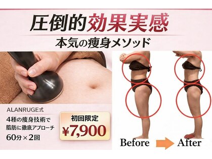 アランルージュ(ALANROUGE)の写真