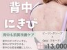 【背中ニキビ改善】ブライダル・夏前★ピーリング×LDMケアで綺麗な背中に♪