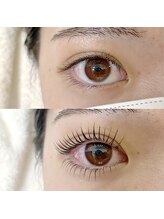 フランセス(Frances)/上下ラッシュリフト