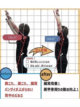 ナオル整体 山形天童院(NAORU整体)/【首肩コリ】頑固な肩こりも◎