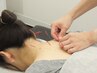 2回目の方限定【辛い首肩こり/頭痛/眼精疲労】スポーツマッサージ＋鍼灸 90分