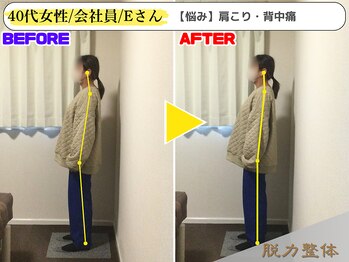 幸せのもり整体院/40代女性/会社員/Eさん