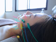 やなけん 亀戸店/2種類の電気で効果を実感