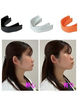 トゥジュール(Toujours)/さつま式マウスピース装着