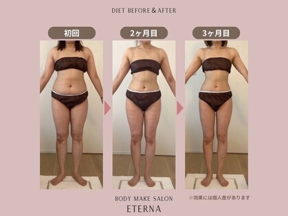 エテルナ(Eterna)の写真