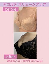 コライユ(corail)/バスト育成ビフォーアフター