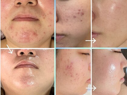 ラ コケット(La Coquette)の写真