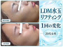 モアナ(MOANA)/LDM水玉リフティング